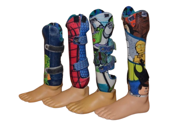Pediatric orthotic fitting